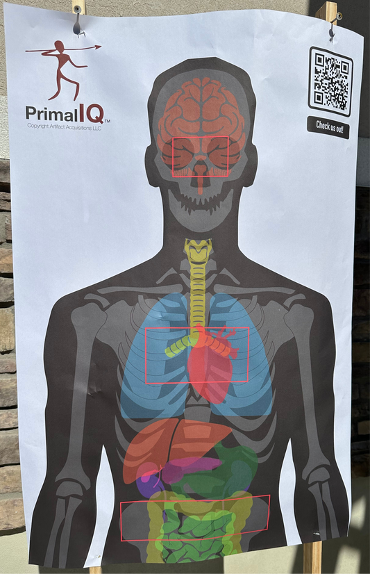 Triple A-Zone Anatomy Target