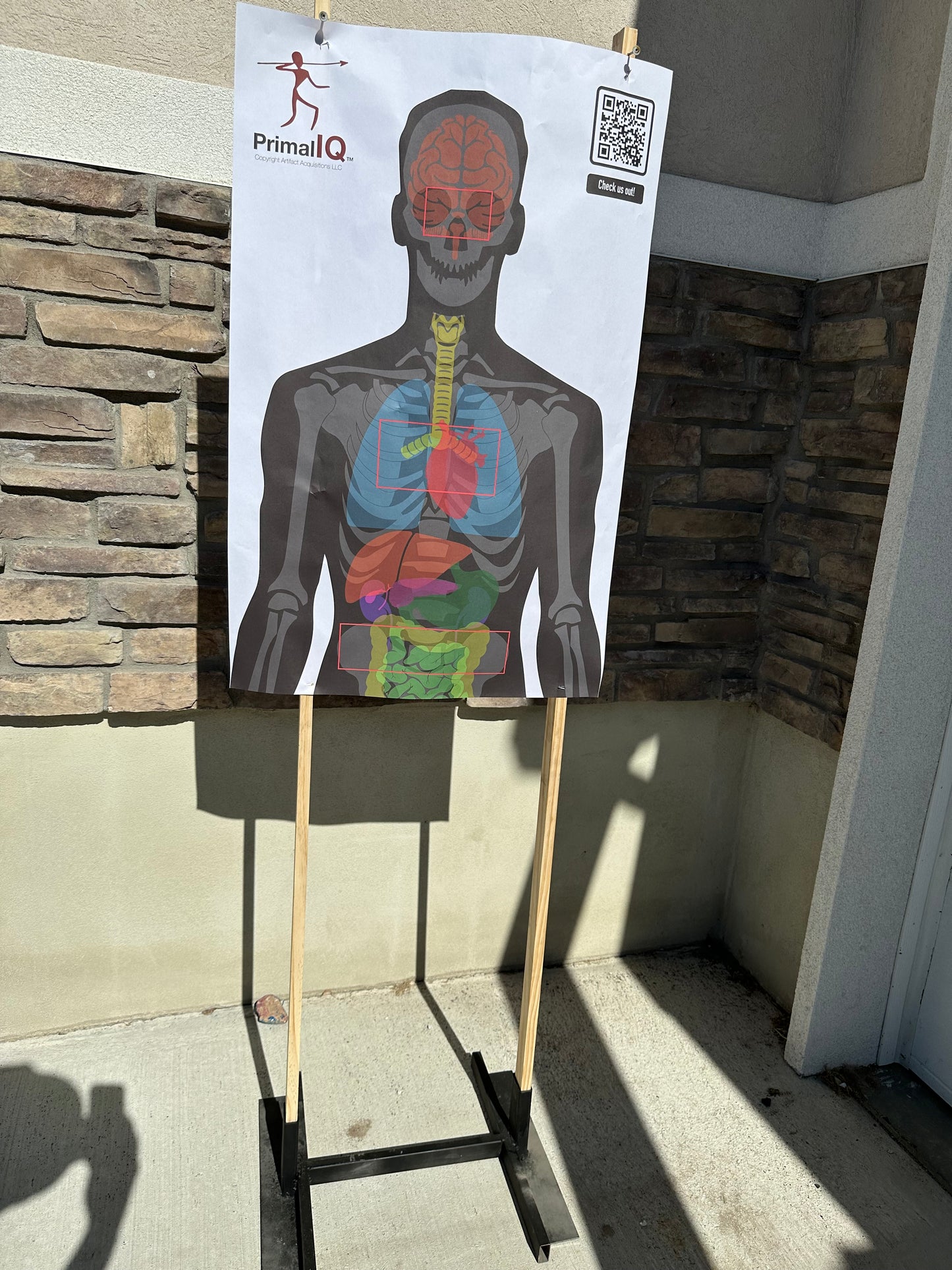 Triple A-Zone Anatomy Target