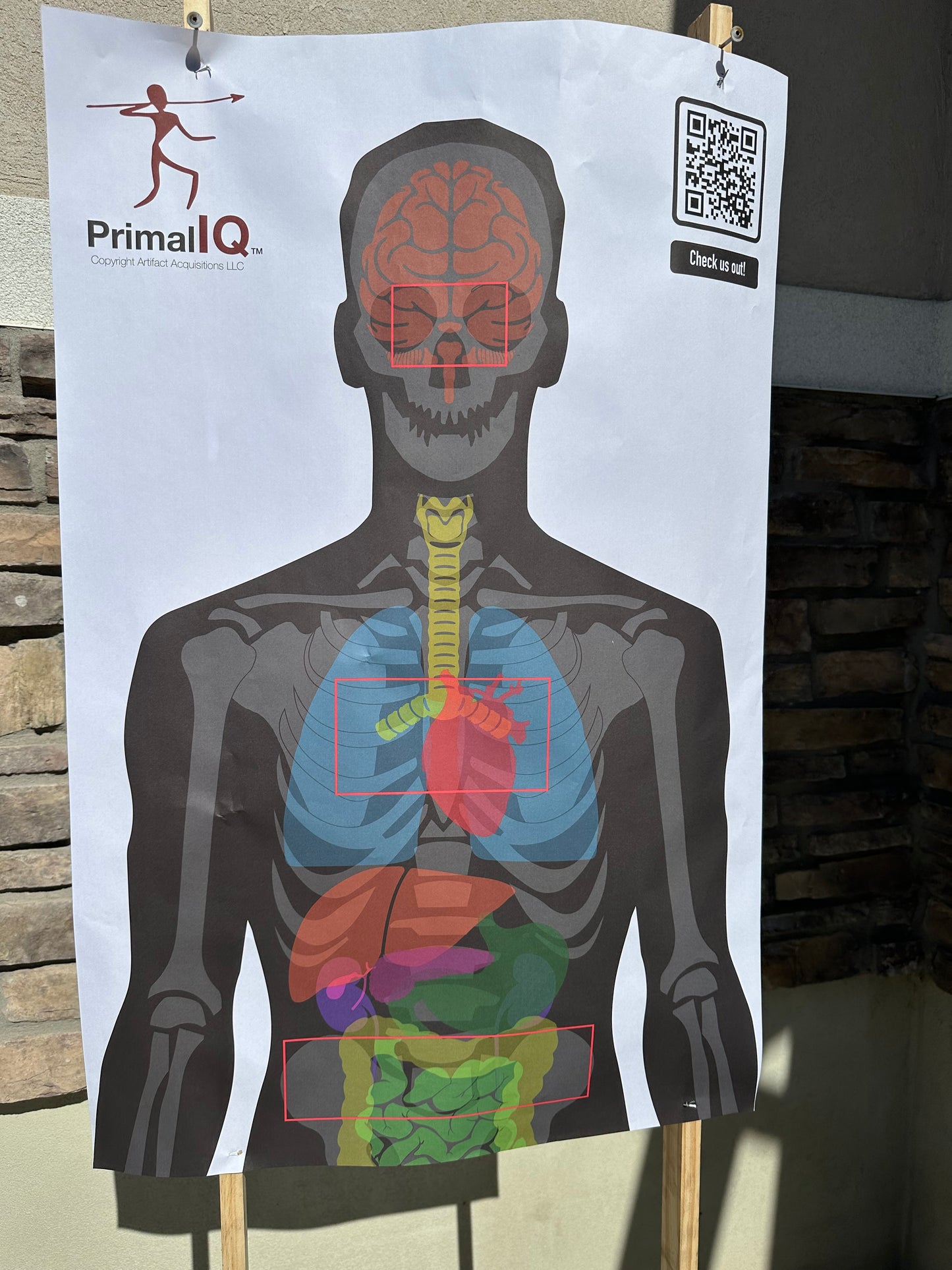 Triple A-Zone Anatomy Target